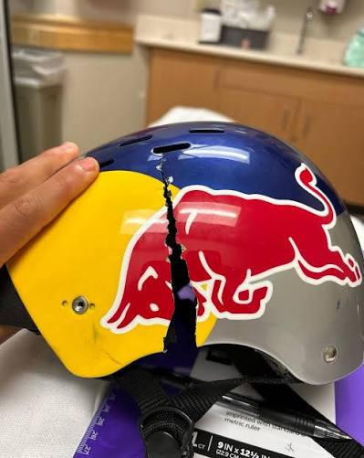 Surfhelm
